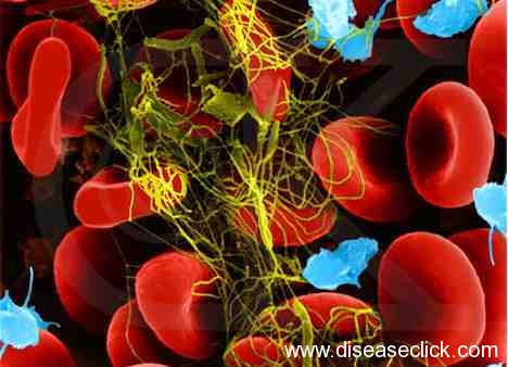 Blood-Vessel-is-Damaged